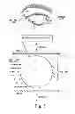Fig. 06 - METHODS FOR TREATING EYE CONDITIONS