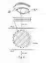 Fig. 09 - METHODS FOR TREATING EYE CONDITIONS
