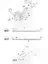 Fig. 02 - Guidewire and method for surgical procedures