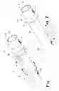 Fig. 02 - Biliary decompression and anastomosis stent