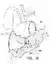 Fig. 09 - Biliary decompression and anastomosis stent