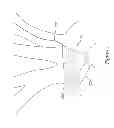 Fig. 02 - Extended protection embolic filter