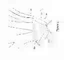 Fig. 03 - Extended protection embolic filter
