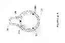Fig. 06 - Extended protection embolic filter