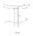 Fig. 06 - System and method for transapical access and closure