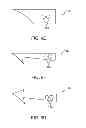 Fig. 41 - System and method for transapical access and closure