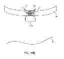 Fig. 43 - System and method for transapical access and closure
