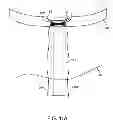 Fig. 44 - System and method for transapical access and closure