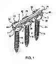 Fig. 02 - Spinal fixation system having locking and unlocking devices for use with a multi-planar, taper lock screw