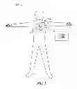 Fig. 02 - Method and apparatus for cardiac protection pacing