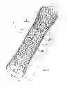 Fig. 02 - Esophageal stent with valve