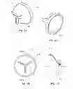 Fig. 07 - Esophageal stent with valve