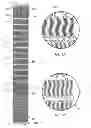 Fig. 08 - Esophageal stent with valve