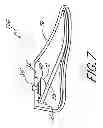Fig. 08 - Low profile prosthetic foot