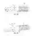 Fig. 13 - Hair Styling Implement with Retractable Bristles
