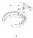 Fig. 02 - Removable insert for a horseshoe