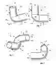 Fig. 03 - Polymer mixer powered by hydrodynamic forces