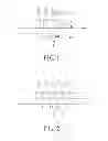 Fig. 02 - MODULE IC PACKAGE STRUCTURE HAVING A METAL SHIELDING FUNCTION FOR PREVENTING ELECTRICAL MALFUNCTION INDUCED BY SHORT-CIRCUIT