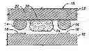 Fig. 01 - Semiconductor device and method of forming a metallurgical interconnection between a chip and a substrate in a flip chip package