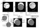 Fig. 01 - Imaging system and method for use in surgical and interventional medical procedures
