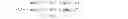 Fig. 06 - Differential pulse code modulation intra prediction for high efficiency video coding