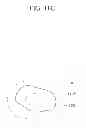 Fig. 18 - Apparatus and method for detecting error in lesion contour, apparatus and method for correcting error in lesion contour, and apparatus for inspecting error in lesion contour