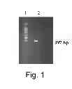 Fig. 02 - FGL-2 prothrombinase as a diagnostic tool for malignancy