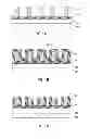 Fig. 02 - Dry Etch Processes