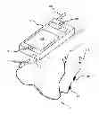 Fig. 01 - Microphone line based detection of headset plug removal