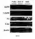 Fig. 02 - Methods and compositions for increasing sensitivity to tyrosine kinase inhibitors