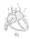 Fig. 02 - System for identifying the location of a device within a patient's body in order to locate the fossa ovalis for trans-septal procedures