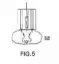Fig. 06 - IMPLANTABLE IMAGING ARRANGEMENT AND METHOD FOR USING THE SAME