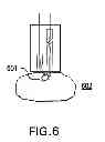 Fig. 07 - IMPLANTABLE IMAGING ARRANGEMENT AND METHOD FOR USING THE SAME