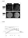 Fig. 03 - X-RAY IMAGING AT LOW CONTRAST AGENT CONCENTRATIONS AND/OR LOW DOSE RADIATION