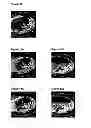 Fig. 07 - X-RAY IMAGING AT LOW CONTRAST AGENT CONCENTRATIONS AND/OR LOW DOSE RADIATION