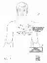 Fig. 02 - SYSTEMS AND METHODS FOR PREDICTING AND CORROBORATING PULMONARY FLUID OVERLOADS USING AN IMPLANTABLE MEDICAL DEVICE