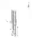 Fig. 08 - Catheter including a bare metal hypotube
