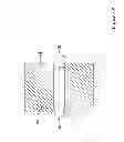 Fig. 09 - Catheter including a bare metal hypotube