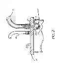 Fig. 03 - Control circuit and method for negative pressure wound treatment apparatus
