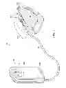 Fig. 02 - Reduced-pressure, multi-orientation, liquid-collection canister