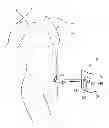 Fig. 01 - Ostomy pouch apparatus with closable opening
