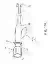 Fig. 20 - Catheter cannula with anchoring elements, catheter including thereof, and/or catheterization method using thereof