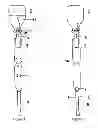 Fig. 02 - INTRAVENOUS INFUSION DEVICE WITH DRIP CHAMBER AND ELASTIC FLOAT