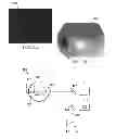 Fig. 03 - Retinal laser surgery