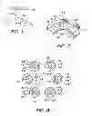 Fig. 02 - System and Method for Correcting Higher Order Aberrations with Changes in Intrastromal Biomechanical Stress Distributions