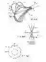 Fig. 09 - Ablation catheter