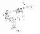 Fig. 02 - External fixation
