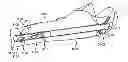 Fig. 01 - Straight intramedullary fracture fixation devices and methods