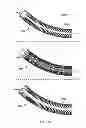 Fig. 28 - Straight intramedullary fracture fixation devices and methods