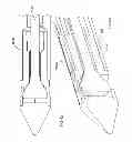 Fig. 37 - Straight intramedullary fracture fixation devices and methods